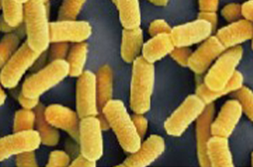 Lactobacillus rhamnosus Lr-G14 