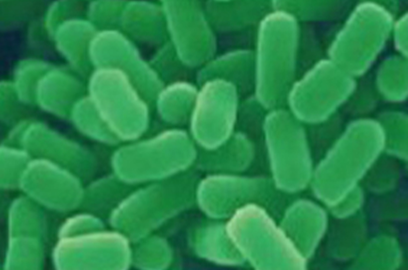 Lactobacillus plantarum Lp-G18 